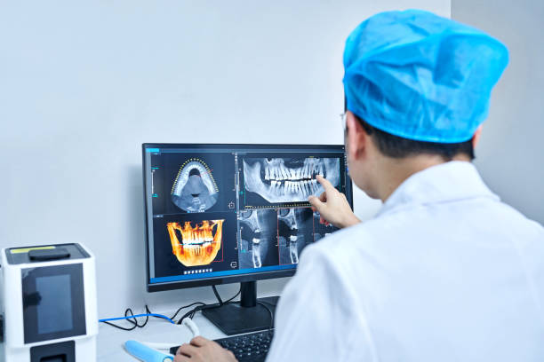 Best Knocked-Out Tooth (Avulsed Tooth) Treatment in Woodville, FL